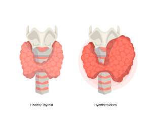 Fertility Speciaist Thyroid - PSFC