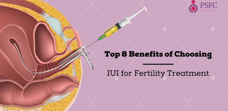 Top 8 Benefits of Choosing IUI for Fertility Treatment