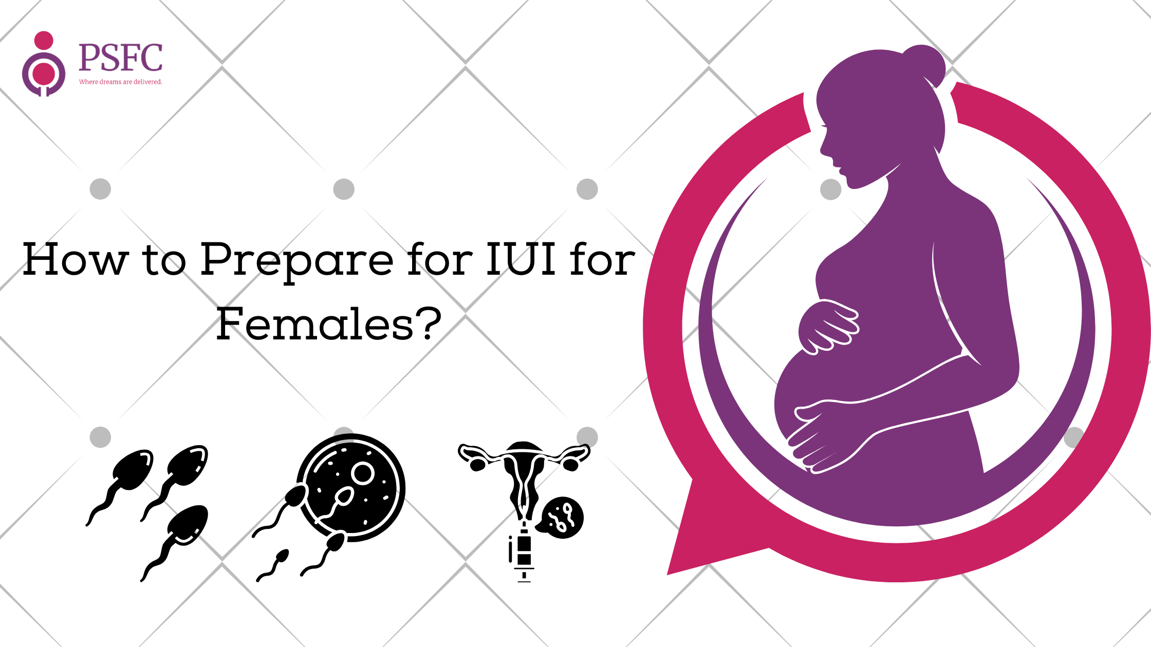 How to Prepare for IUI for Females